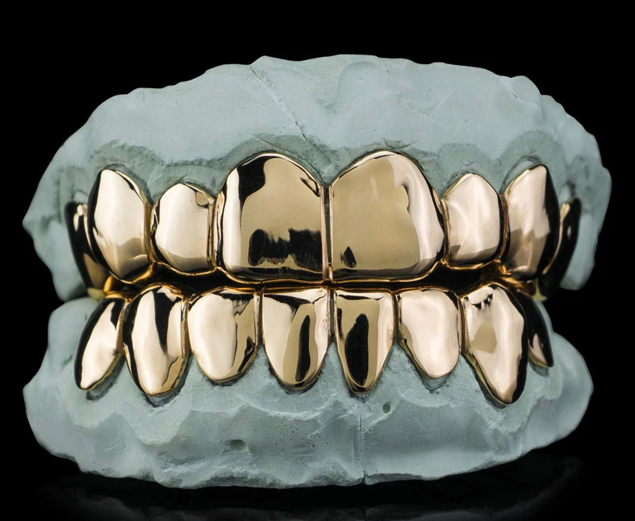 Gold grillz